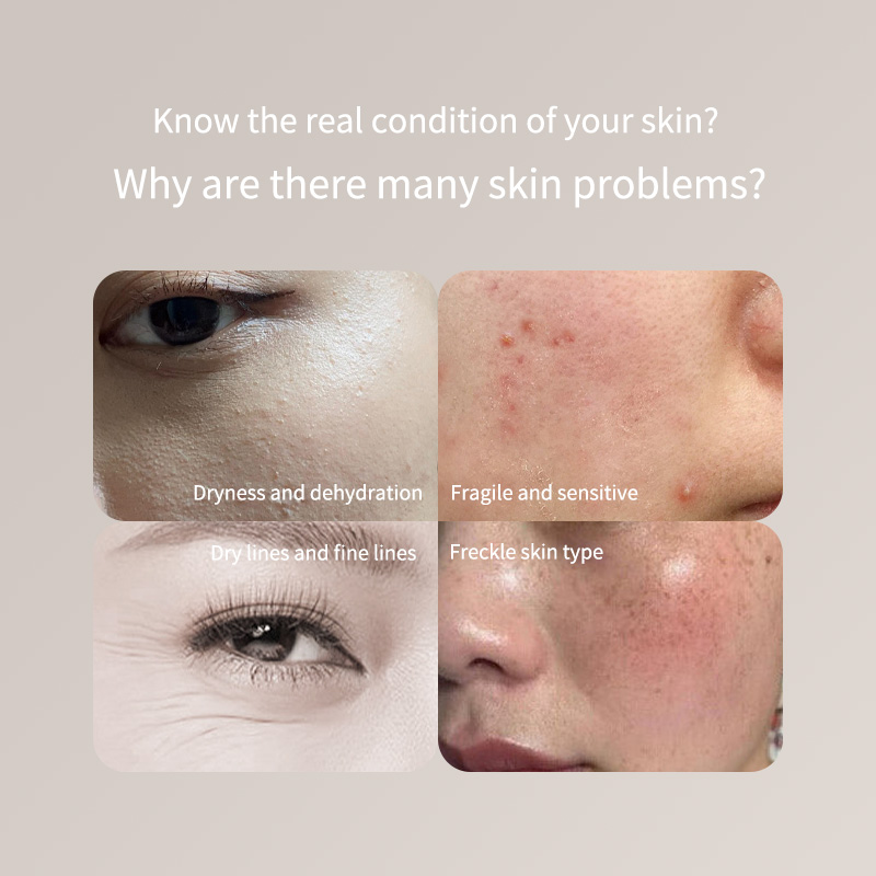 Skincare Only You - Портативная ручка-тестер кожи - для лица